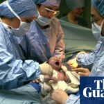 NHS-Daten zeigen, dass jedes vierte Baby in England per Kaiserschnitt geboren wurde