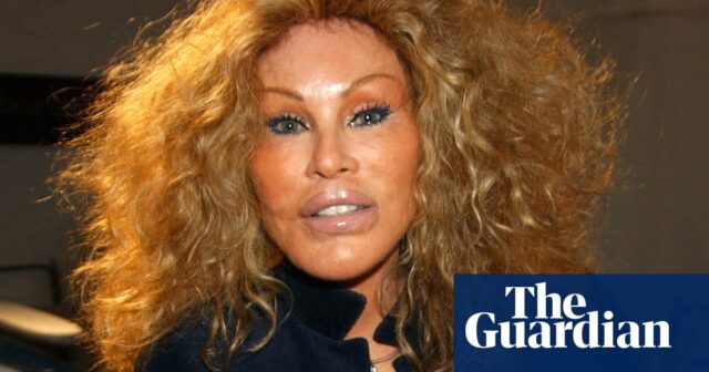 Jocelyne Wildenstein, Prominente, die für extreme katzenartige Schönheitsoperationen bekannt ist, ist gestorben

