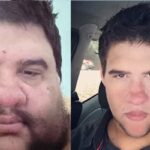 Der brasilianische Influencer, der 174 kg abgenommen hatte, starb im Alter von 37 Jahren