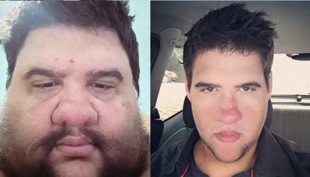 Der brasilianische Influencer, der 174 kg abgenommen hatte, starb im Alter von 37 Jahren

