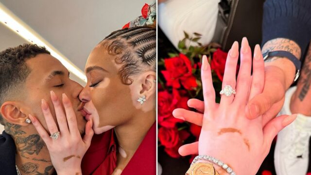 Kyle Kuzma verlobt Winnie Harlow, schlägt mit 8,5 Karat -Diamantring vor

