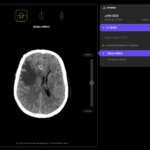 Australian Health Technology Startup Harrison.ai erhält 112 Millionen US -Dollar Serie C.