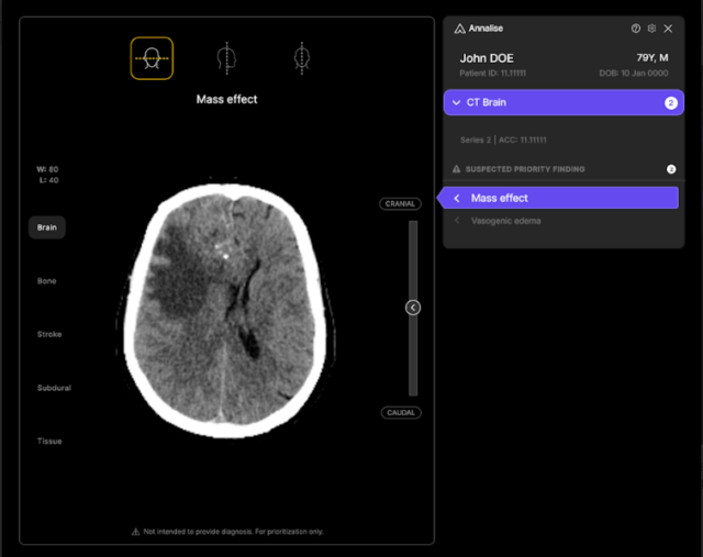 Australian Health Technology Startup Harrison.ai erhält 112 Millionen US -Dollar Serie C.

